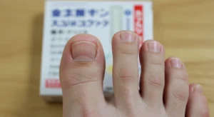 일본발톱무좀약 주블리아 타무시친키 핵심 정보